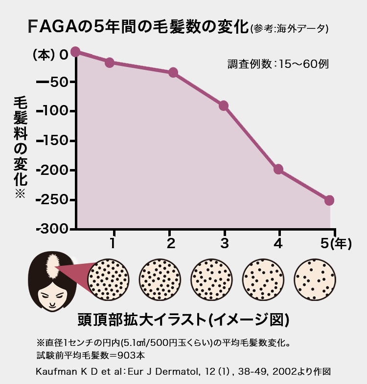 頭頂部拡大イラスト（イメージ図）