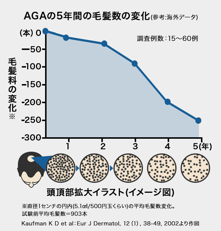 頭頂部拡大イラスト（イメージ図）